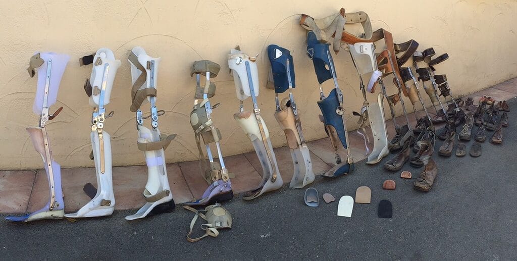 many of martys leg braces all lined up against a wall from small to big with orthotic shoes lifts and accessories
